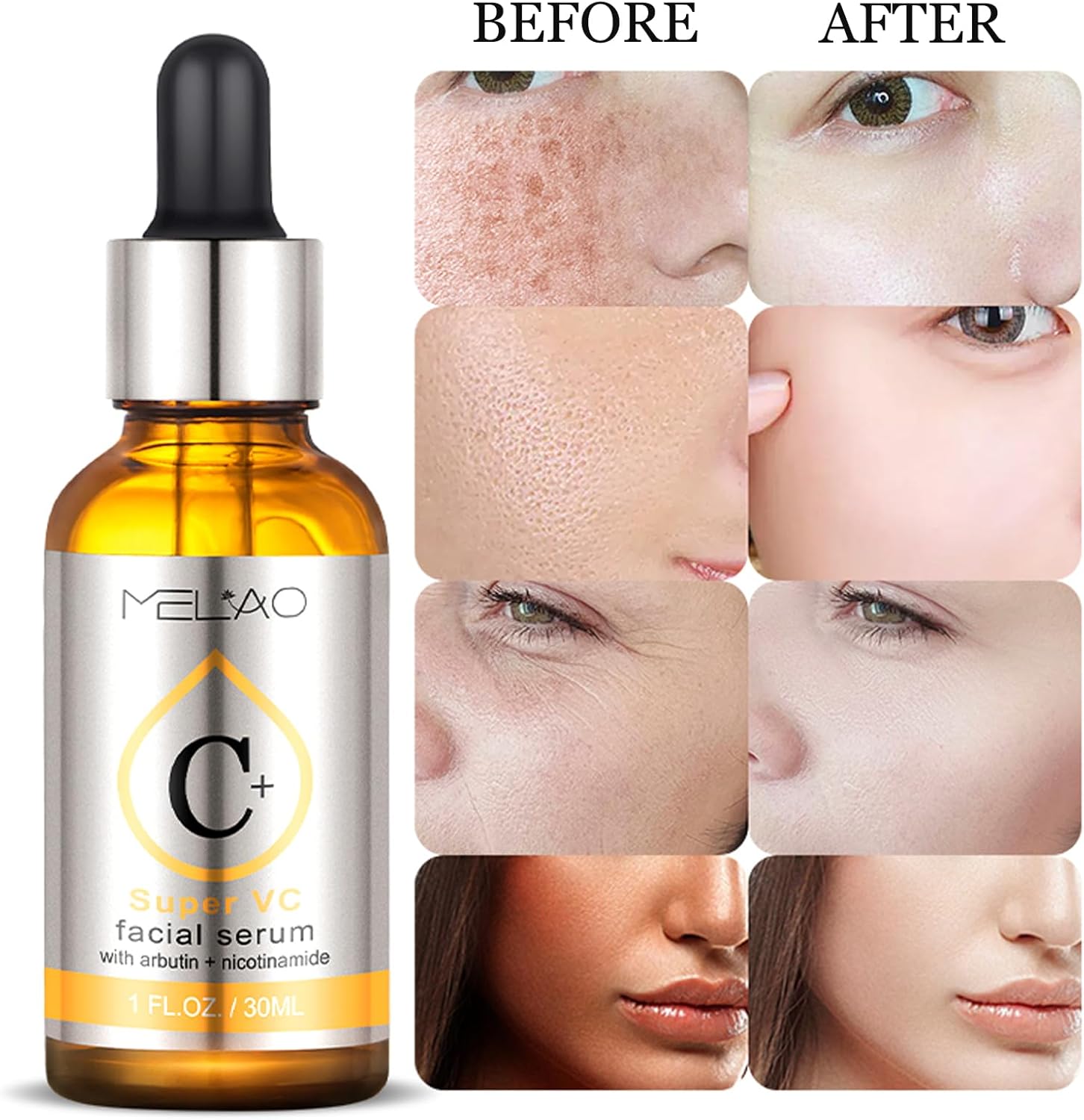 Vitamin C Arbutin Serum, Face Serum With Hyaluronic Acid,Arbutin,5% Vitamin C, Skin Care For Hydrate, Brightening, Dark Spot Remover For Face, Organic & Vegan Formula, Absorbs Easily