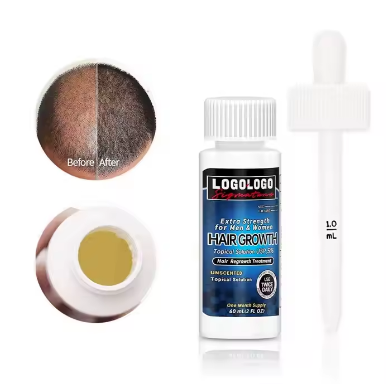 5% Extra Strength Men Hair Regrowth Solution