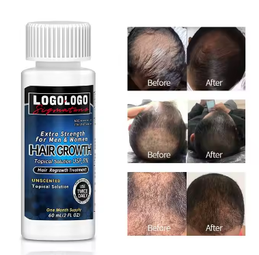 5% Extra Strength Men Hair Regrowth Solution